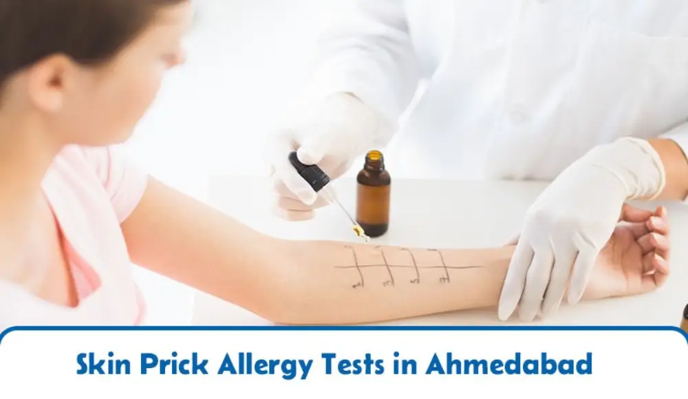 Skin Prick Allergy Tests in Ahmedabad