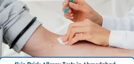 Skin Prick Allergy Tests in Ahmedabad