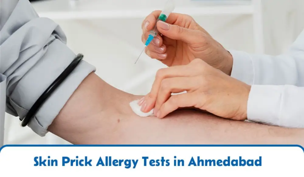 Skin Prick Allergy Tests in Ahmedabad