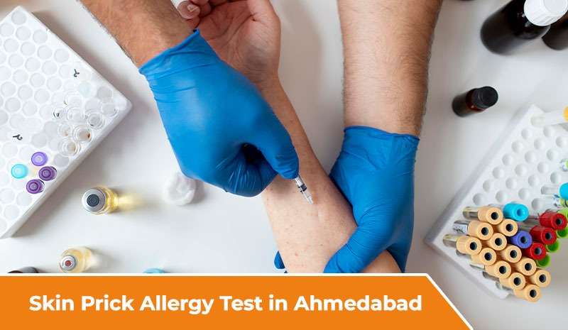 Skin Prick Allergy Test in Ahmedabad