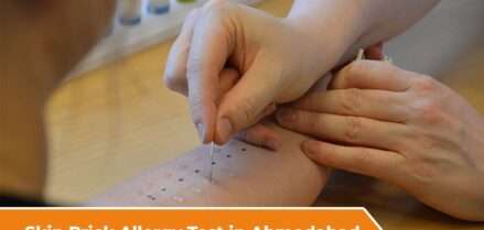 Skin Prick Allergy Test in Ahmedabad