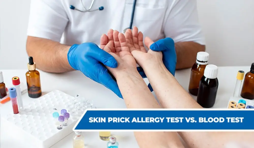 Skin Prick Allergy Test vs. Blood Test