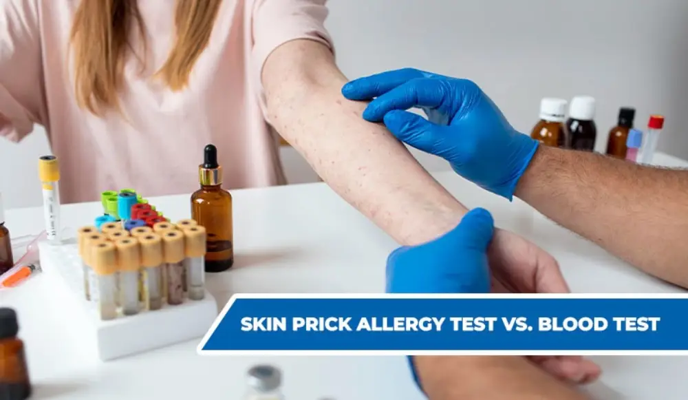 Skin Prick Allergy Test vs. Blood Test