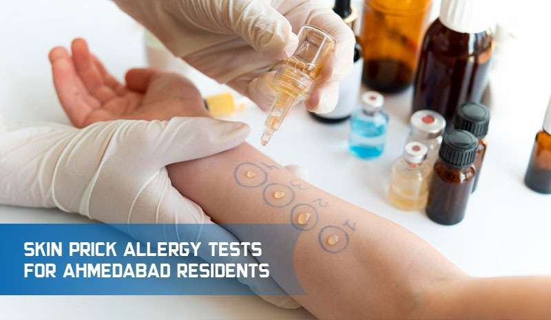 Skin Prick Allergy Tests For Ahmedabad Residents