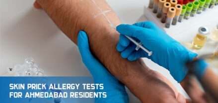 Skin Prick Allergy Tests For Ahmedabad Residents