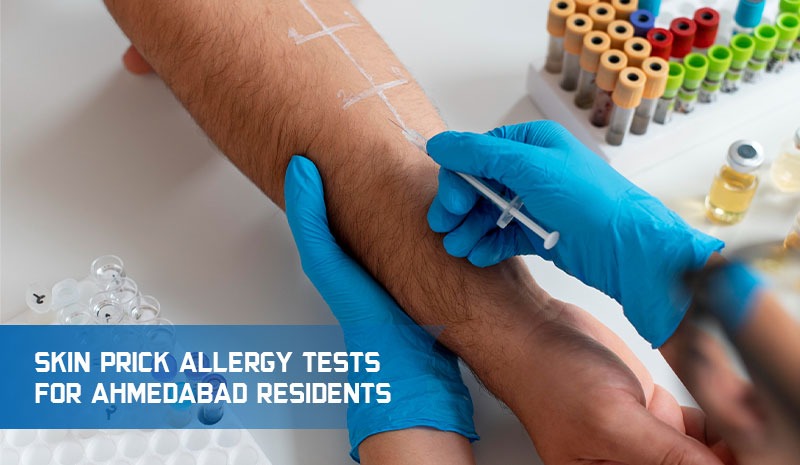 Skin Prick Allergy Tests For Ahmedabad Residents