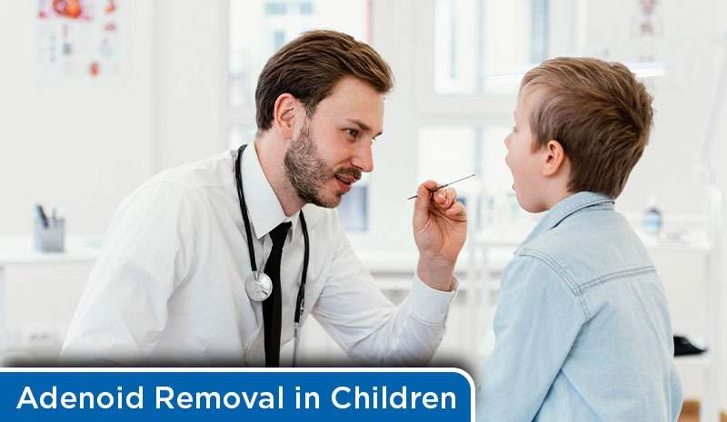 Adenoid Removal in Children