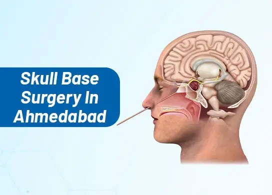 Skull Base Surgery in Ahmedabad