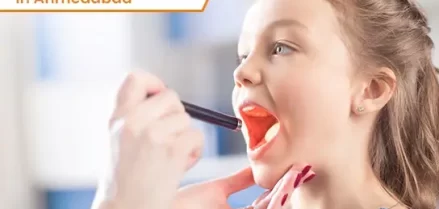 Coblation Tonsillectomy in Ahmedabad