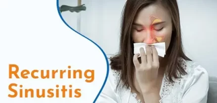 Recurring Sinusitis