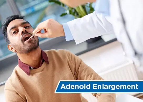 Adenoid Enlargement