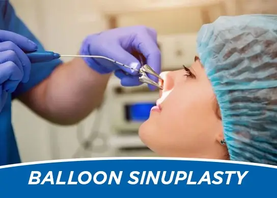 Balloon Sinuplasty