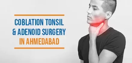 Coblation Tonsil and Adenoid Surgery in Ahmedabad
