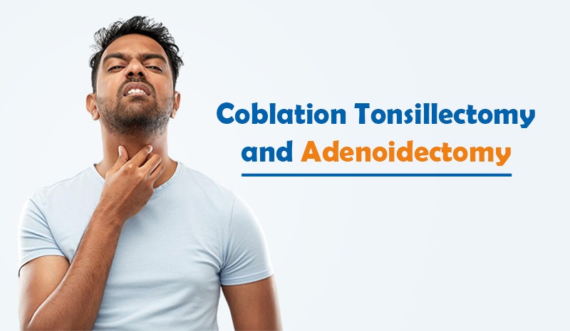 Coblation Tonsillectomy and Adenoidectomy