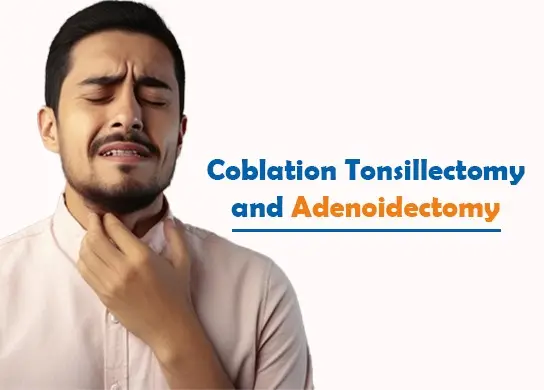 Coblation Tonsillectomy and Adenoidectomy