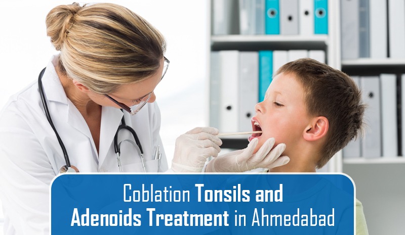 Coblation Tonsils and Adenoids Treatment in Ahmedabad