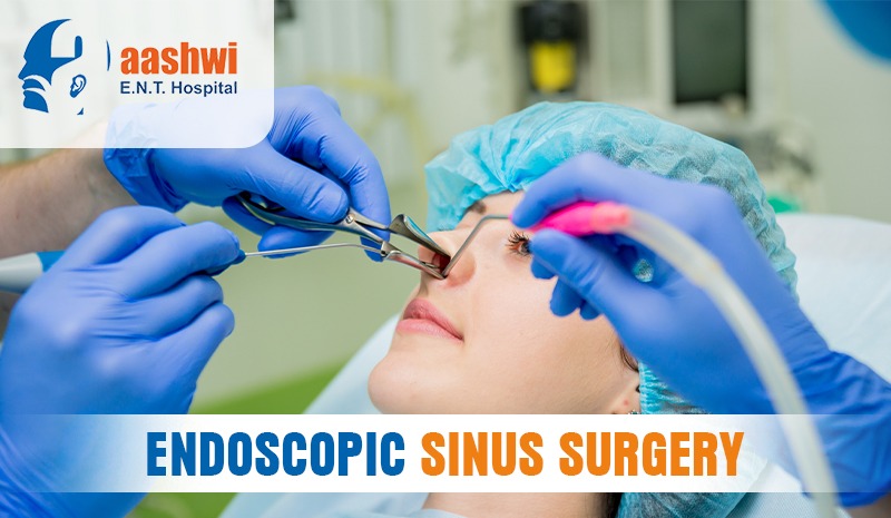 Endoscopic Sinus Surgery