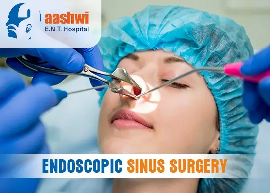 Endoscopic Sinus Surgery