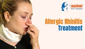 Allergic Rhinitis Treatment