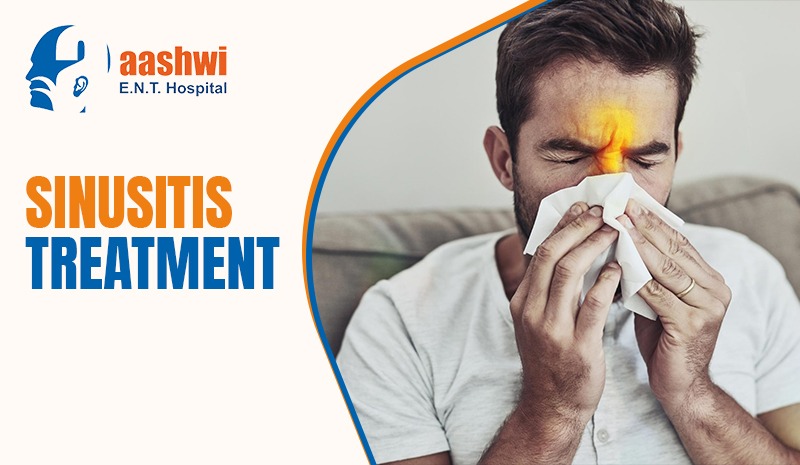 Sinusitis Treatment