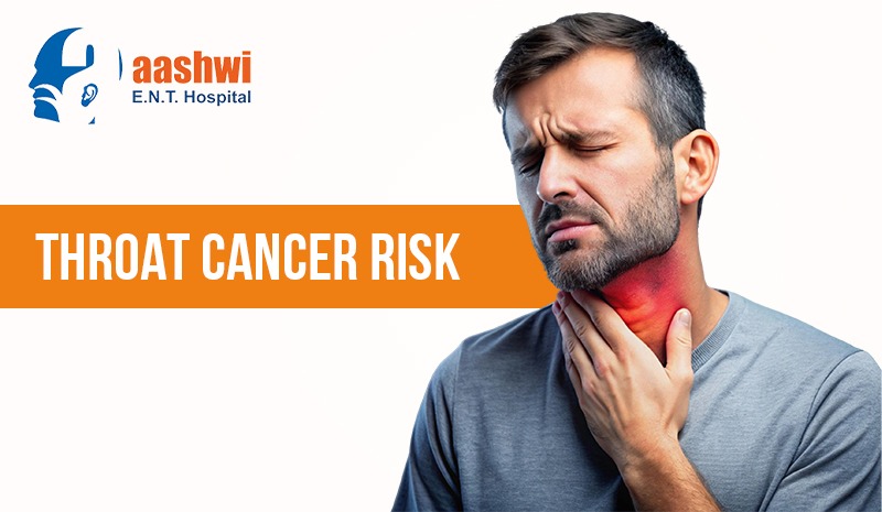 Throat Cancer Risk